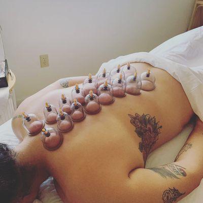 Cupping 70$ a hour or 30$ add on a wonderful way to get rid of that tight tension!