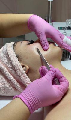 Dermaplaining Add on to any facial