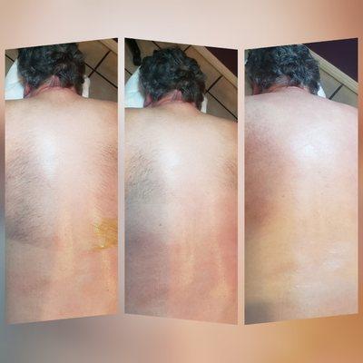 Mens back wax