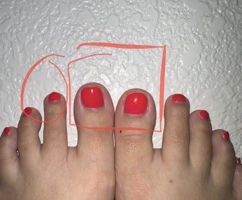 Uneven shaping amongst toes