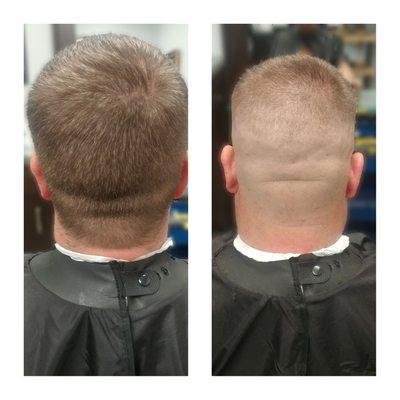 Medium High Bald Fade