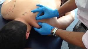 Dr. Mick has used dry needling in his practice for almost 30 years working with top athletes to help them heal and achieve peak performance.