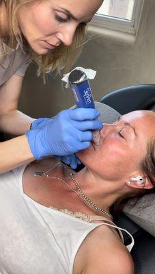 SkinPen Medical Microneedling