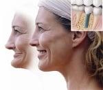 Dental Implants can restore your appearance, improve your ability to eat and chew your food and improve your overall quality ...