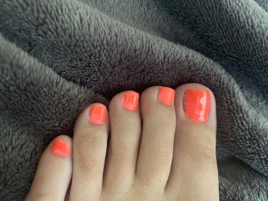 Messy pedicure. Also left the cuticle with a stinging feeling and after scar.