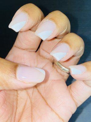 Cracks on all nails