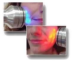 Infrared Wrinkle Therapy.