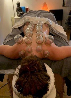 Traditional cupping