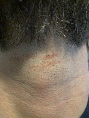 Small cuts to my husbands neck caused by Randy Chris at bull moose barber.