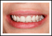 Preventative Dentistry in Port Lavaca, TX