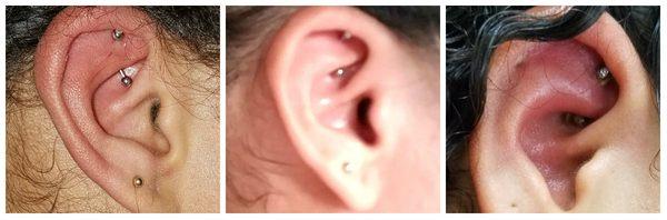 1: initial piercing. 2: during "healing" 3: when i was diagnosed w/ a staph infection a few weeks after getting it done and with proper care