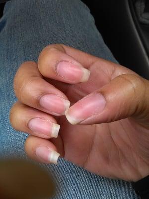 Nail cuticles are all lifted. One nail broken (middle finger).