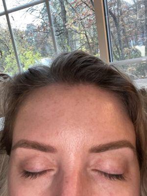 Healed eyebrows!