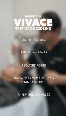 Benefits of RF microneedling