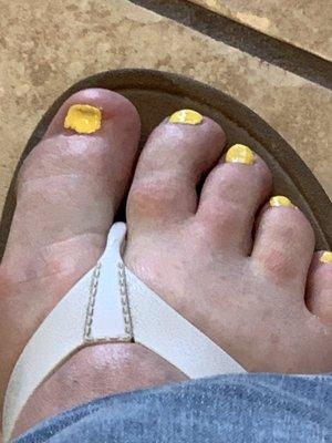 Pedicure