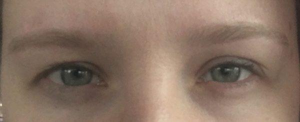 "After" brow service. Typically 25% larger when done at my normal place. Slightly asymmetrical. Acceptable enough if I add makeup.