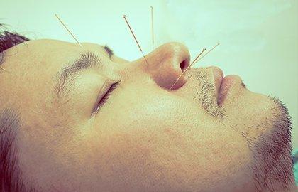 PRIME Physical Therapy Service, Dry Needling