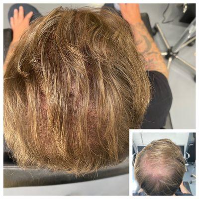 Scalp Micro-Pigmentation offered at 
BOLT
By Valerie
562-712-2007