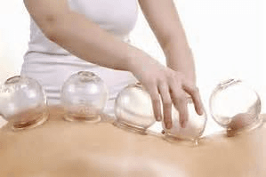 Cupping