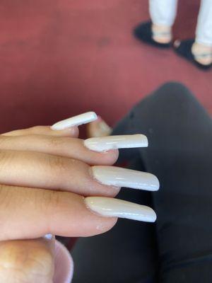 Ugly nails