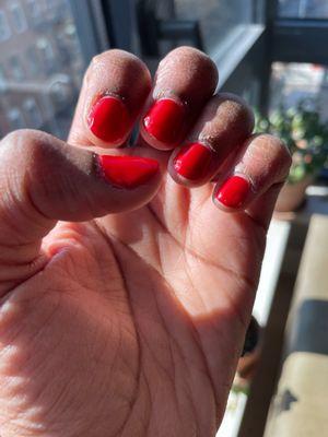 Bad gel manicure.