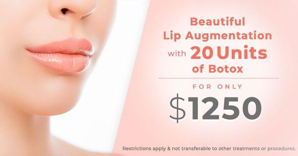 Lip Augmentation Sale Happening Now! Call today for a FREE consultation