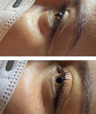 Lash Lift