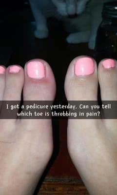 Infected big toe... Hurts so bad