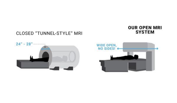 Open MRI.
MRI for Claustrophobic Patients