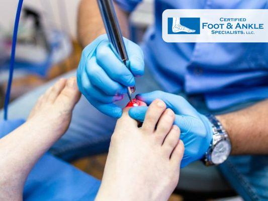 Painful Fungal Toenail Infections