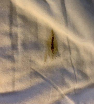 Smeared feces on bed sheets