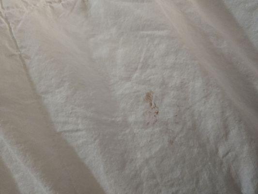 Blood on my sheets. Please check your beds here