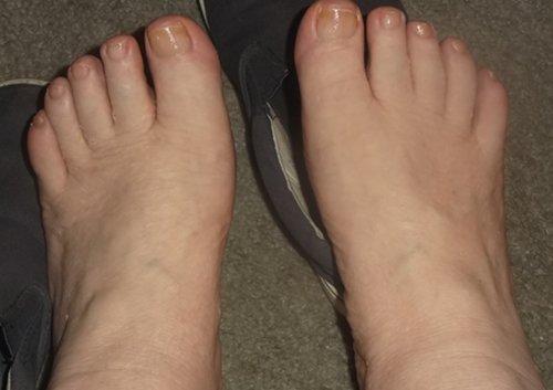 My Feet- "after" my pedicure.  the "before" pic was too gross to post.  :  ).