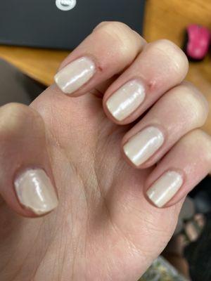 Multiple cuts from the acrylic removal: chipped polish (only day 3)