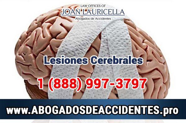 Abogados de Lesiones Cerebrales Los Angeles, https://abogadosdeaccidentes.pro/