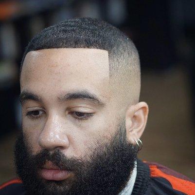 Bald fade