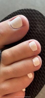 Friends toenails