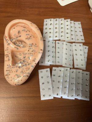 Sparkly crystal ear seeds -an optional addition to an auricular acupuncture treatment.