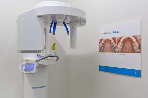 CEREC® CAD/CAM is the epitome of Modern Dentistry. It means that in just 2 hours you can have a crown!