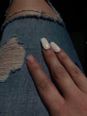 Damaged natural nails