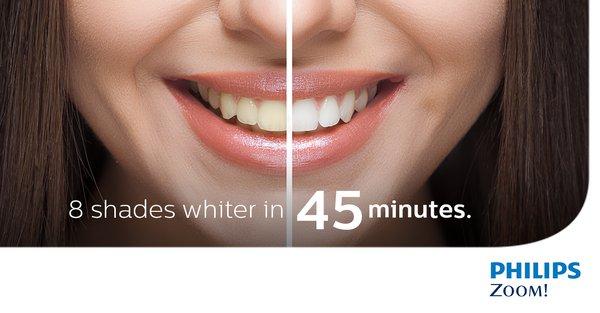 Professional Teeth Whitening