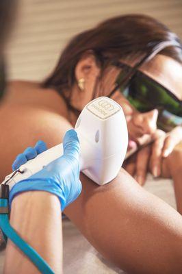 Cooling Laser Hair Removal/Reduction. Triton Laser Hair Diode has a cooling/icing effect that eliminates the chance of burns