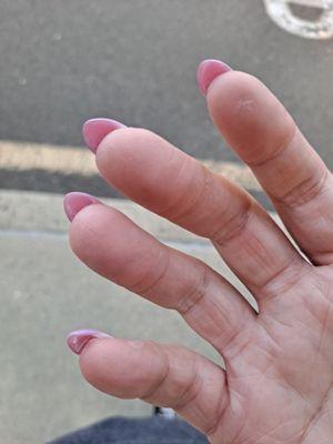 Nail polish and gel left on her skin, nails being oddly shaped, it's two different shades of pink instead of a fade from blue to pink.