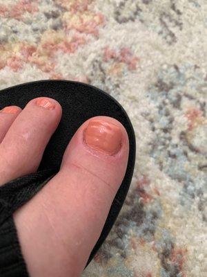 Note the ridges in my nail bed and polish on my cuticle. The other big toe has a nick & I dried for ten minutes.