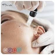 Micro Needling