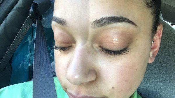 After eyebrow threading and blackhead removal facial