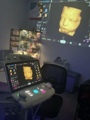 3d baby ultrasound