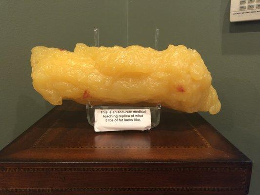 A replica of 5lbs of fat you can see in our entryway.