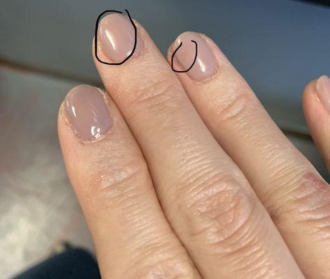 Dark streaks, dry nails.