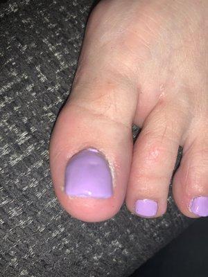 Toe nail tip